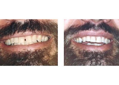 Smile Gallery - Smile Makers Dentist - Baltimore, MD