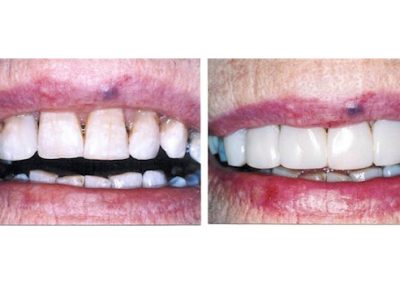 Smile Gallery - Smile Makers Dentist - Baltimore, MD