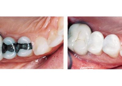 Smile Gallery - Smile Makers Dentist - Baltimore, MD